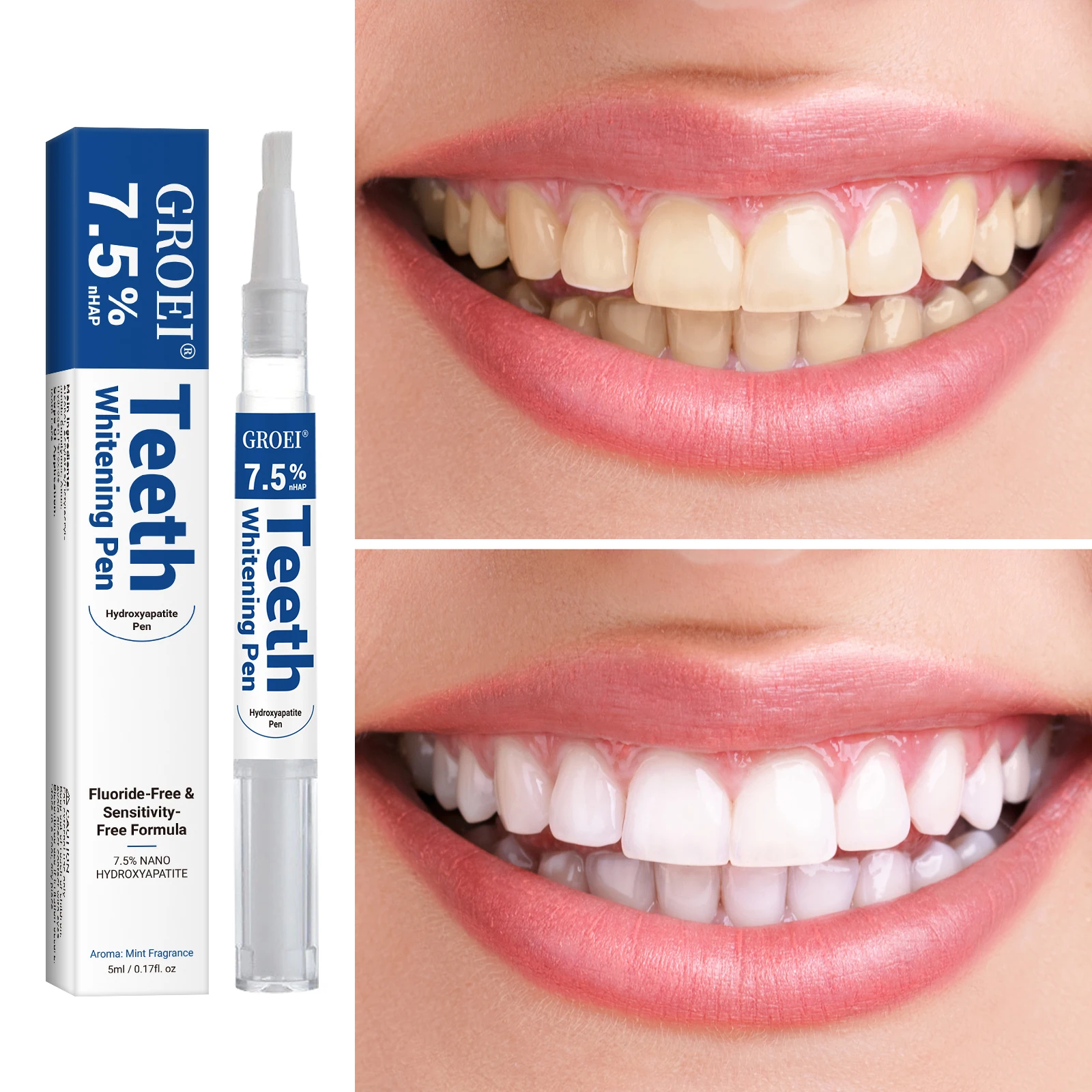 Hydroxyapatite Tooth Whitening - Teeth Whitening With Hydrogen Peroxide 评论和价格