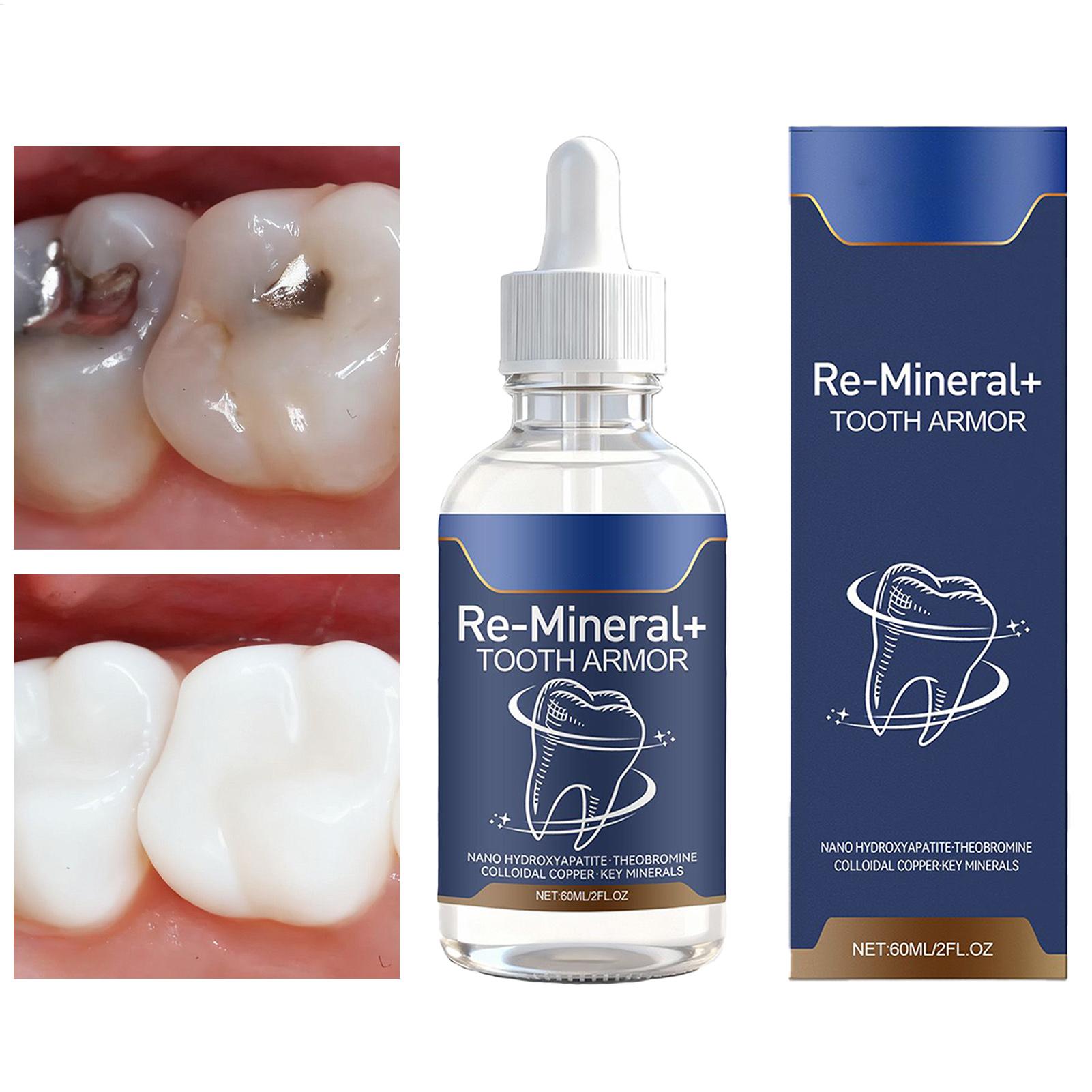 60ml Teeth Cleaning Liquid Rem - Teeth Whitening And Stain Removal 评论和价格