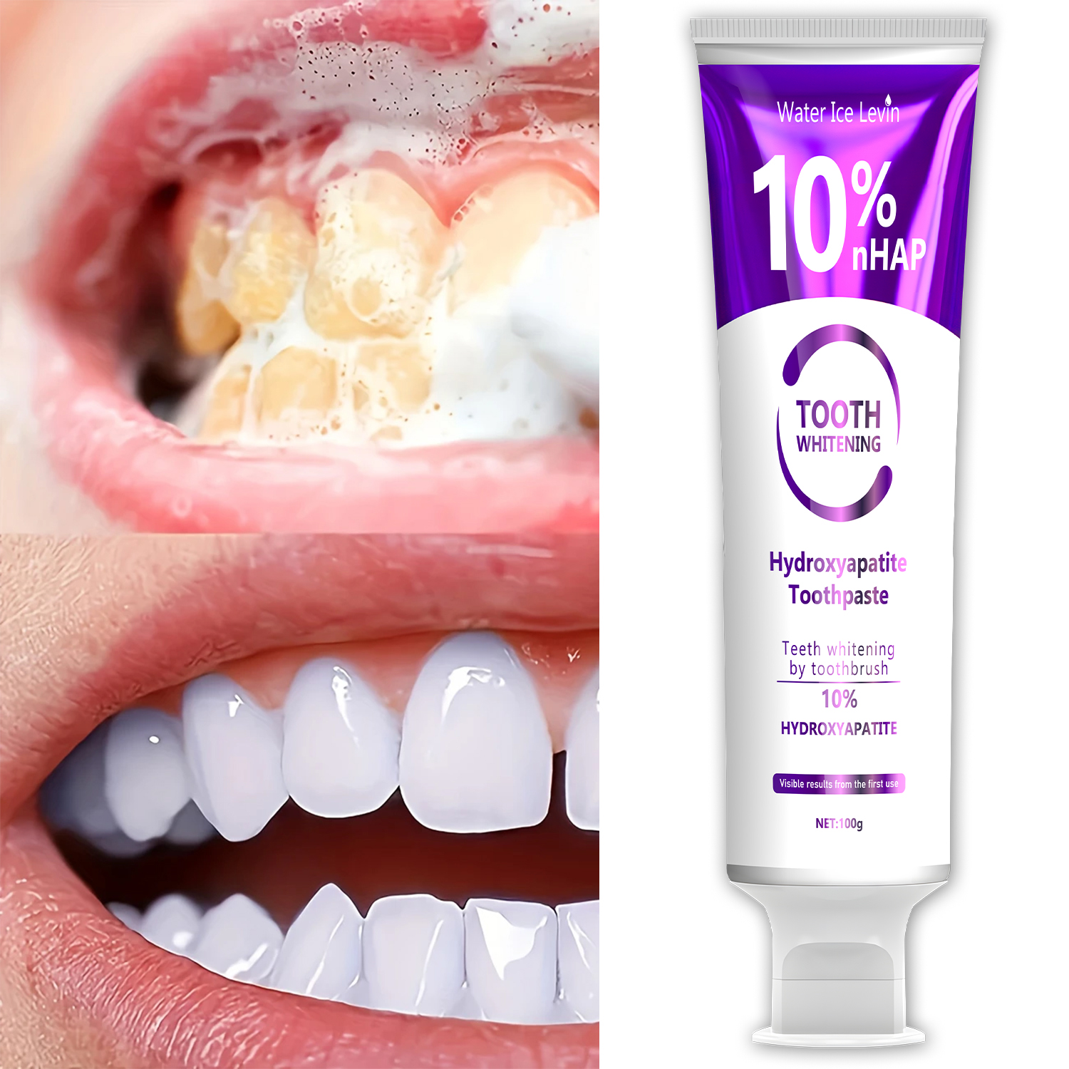 10% Nanoh Hydrogen Oxide Tooth - Teeth Whitening With Hydrogen Peroxide 评论和价格