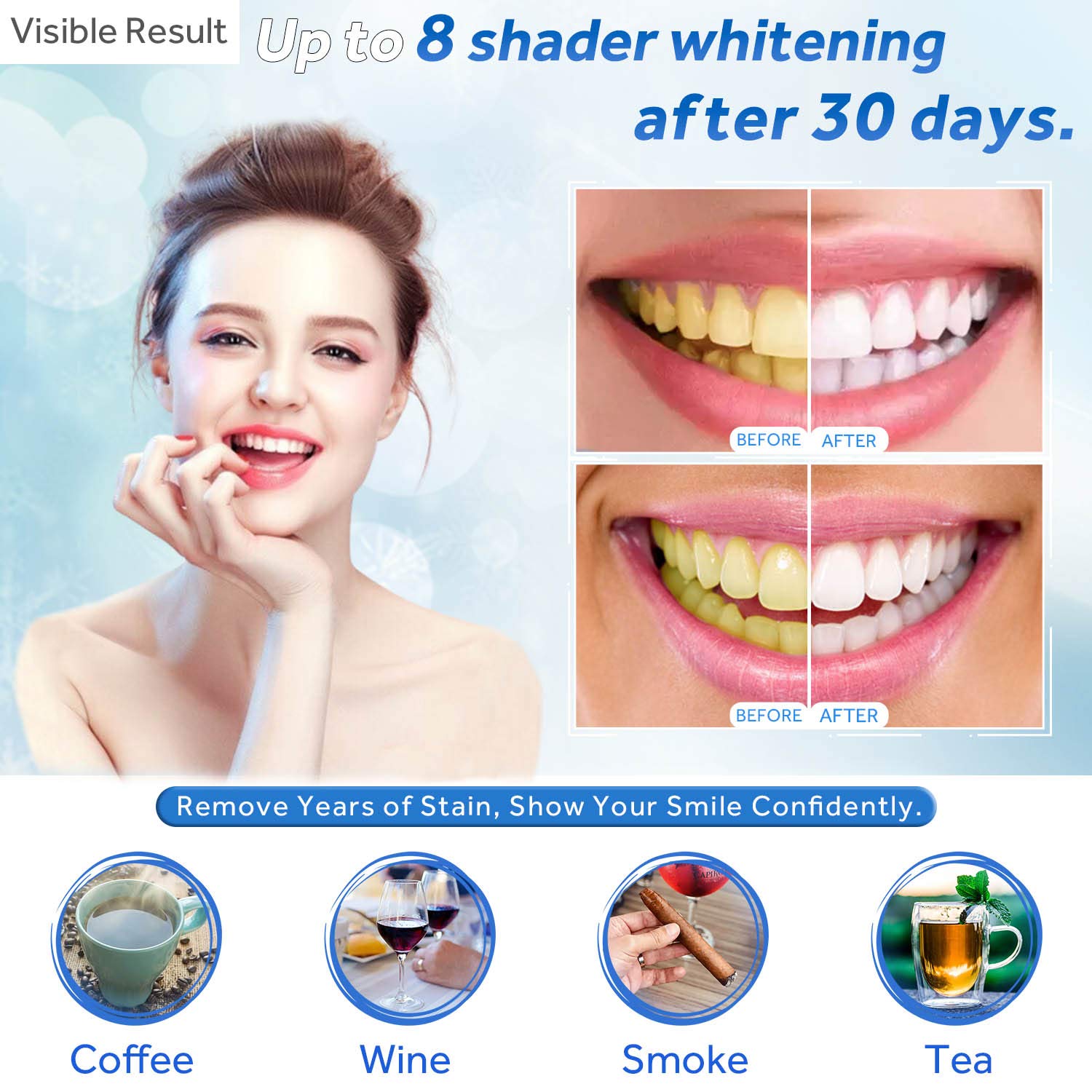 Teeth Whitening Gel Refill Syr - Teeth Whitening With Hydrogen Peroxide 评论和价格