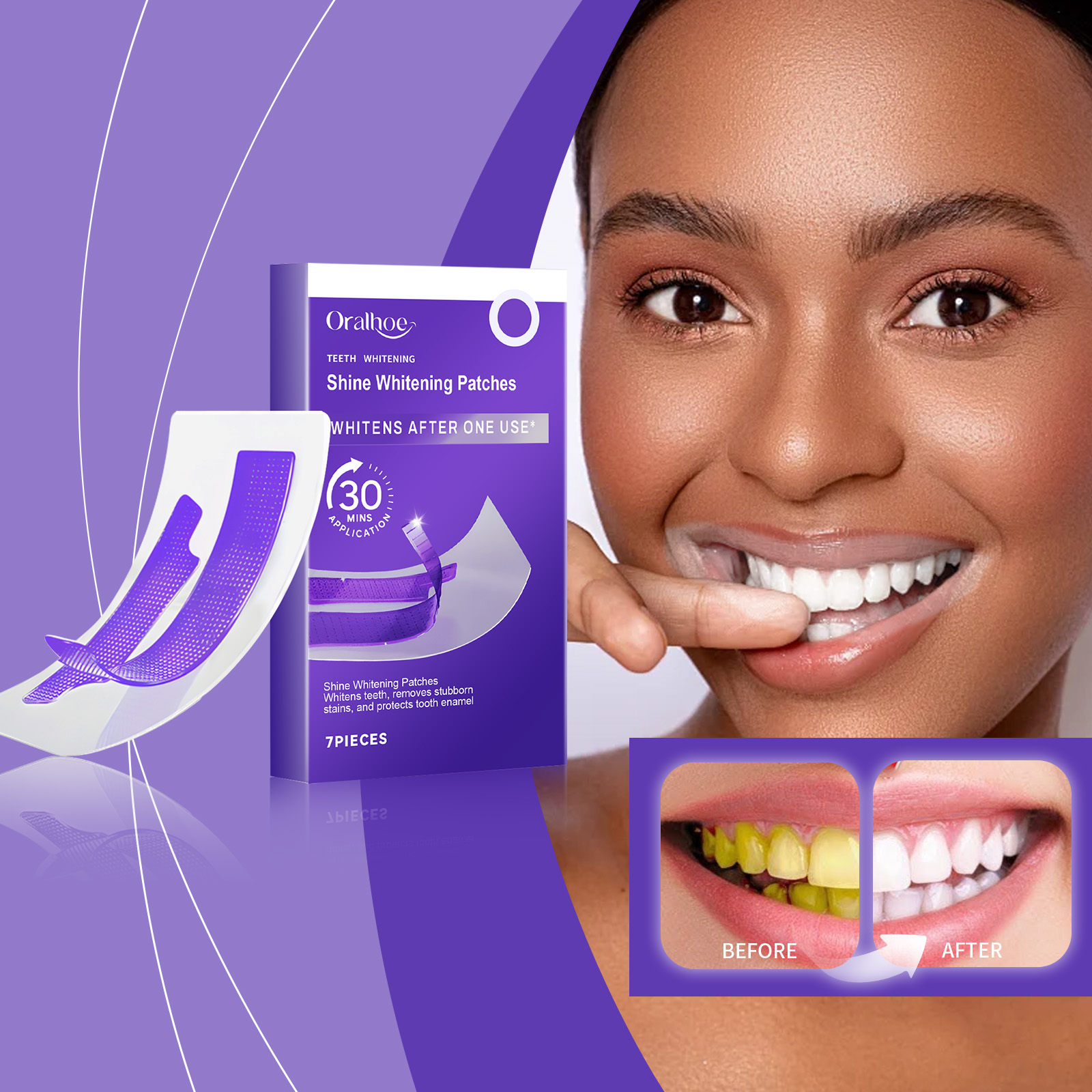 Purple Teeth Whitening Strips  - Teeth Whitening Retainer 评论和价格