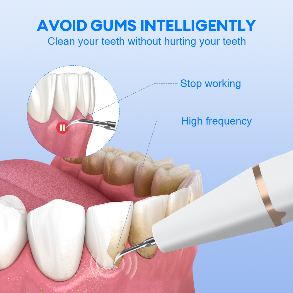 Ultrasonic Teeth Tartar Cleane - Teeth Whitening And Stain Removal 评论和价格