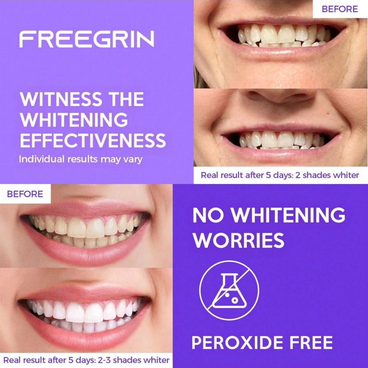 Deluxe Whitening Teeth Sticker - Teeth Whitening With Hydrogen Peroxide 评论和价格