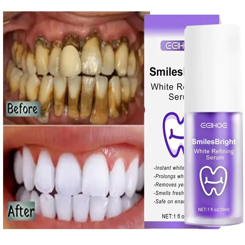 Whitening Toothpaste Teeth Cle - Teeth Whitening Korea 评论和价格