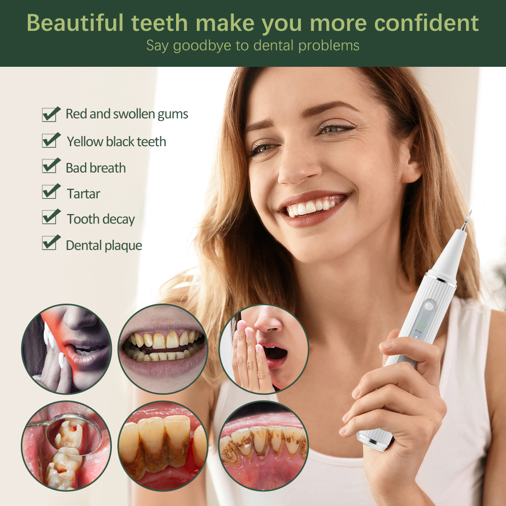 Ultrasonic Visual Dental Calcu - Teeth Whitening And Stain Removal 评论和价格