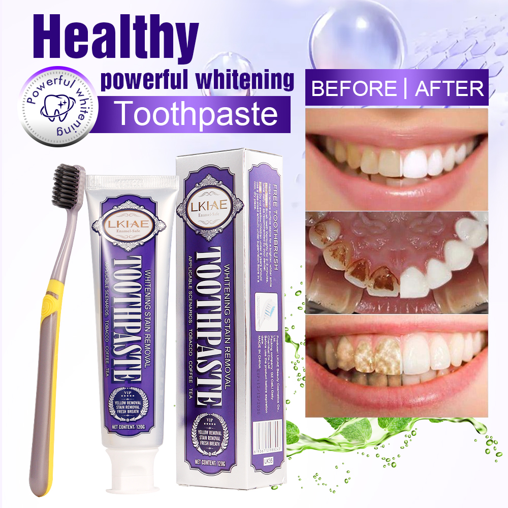 LKIAE White Teeth Whitening To - Teeth Whitening And Stain Removal 评论和价格