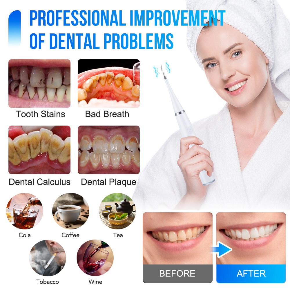 Household Electric Teeth Clean - Teeth Whitening And Stain Removal 评论和价格