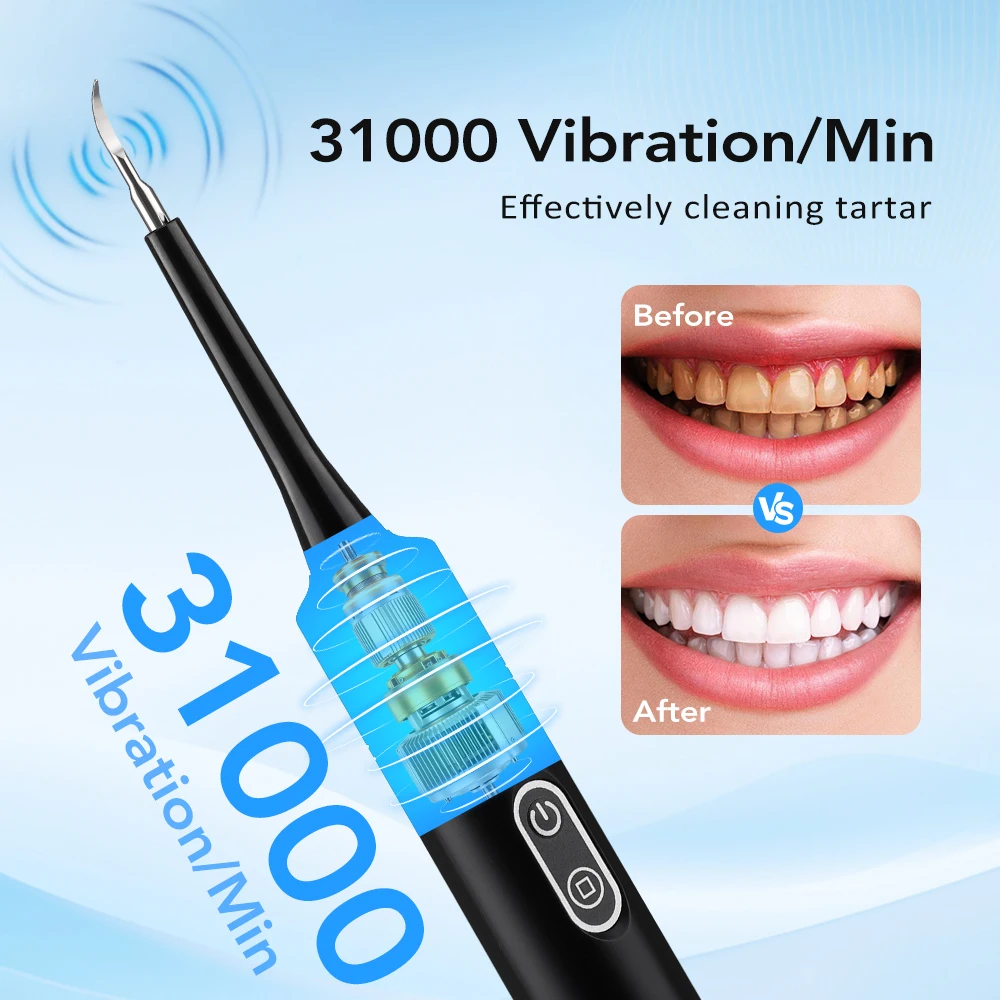 Electric Sonic Vibration Denta - Teeth Whitening And Stain Removal 评论和价格