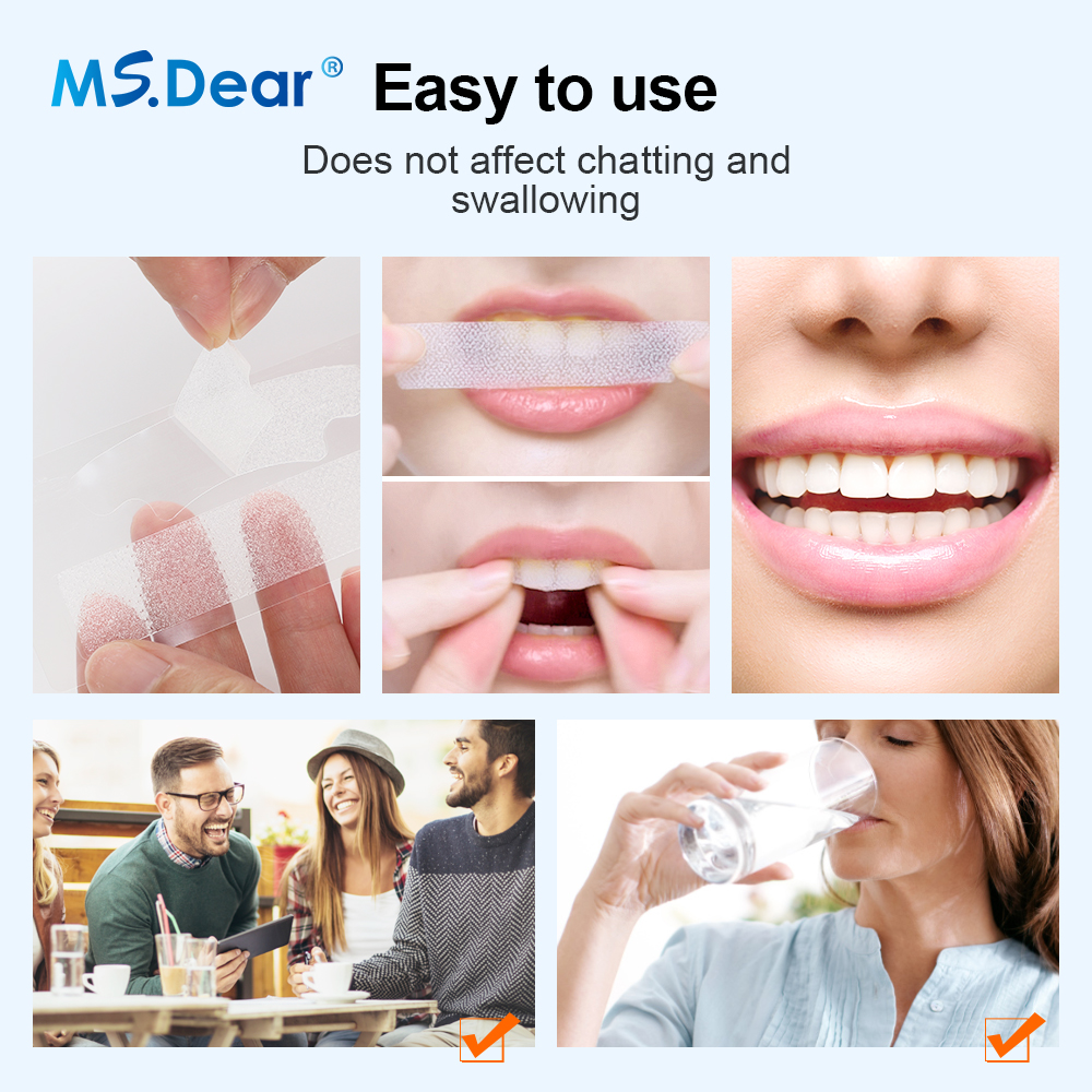 Teeth Whitening Strips Cleansi - Teeth Whitening With Hydrogen Peroxide 评论和价格
